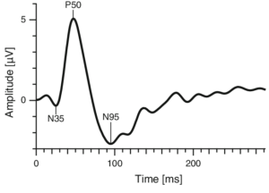P50 waveform of sensory gating